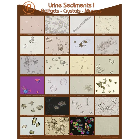 Marketlab Urine Sediments Posters and Binder Cards