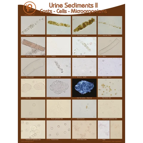 Marketlab Urine Sediments Posters and Binder Cards