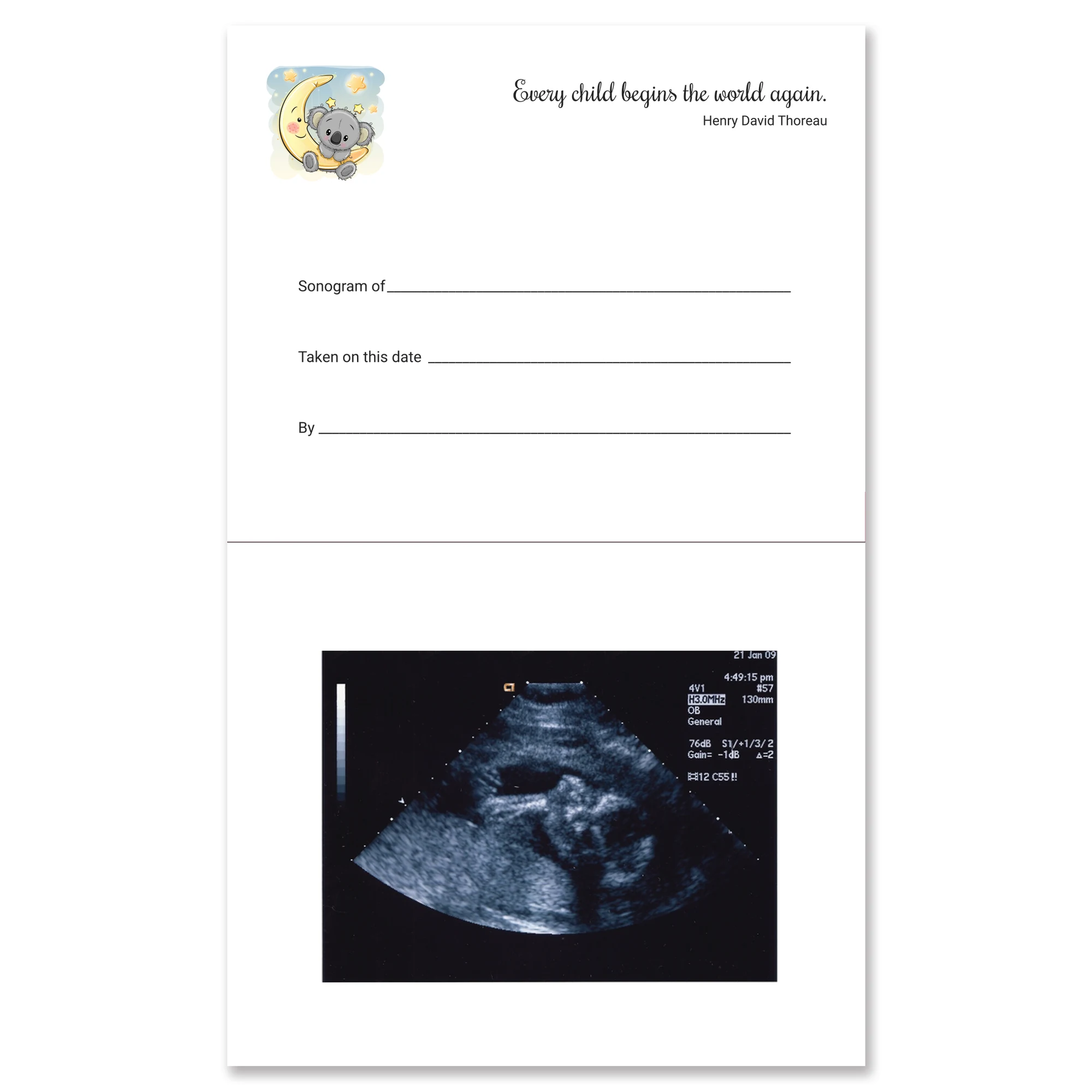 Cone Instruments/Marketlab-949900 Sonogram Cards, 25/pk