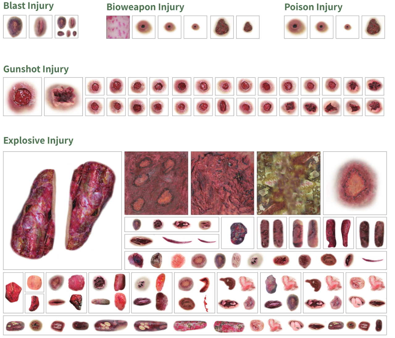 The Anatomy Lab-A-112997 Trauma Quick Kit - 8 Sets