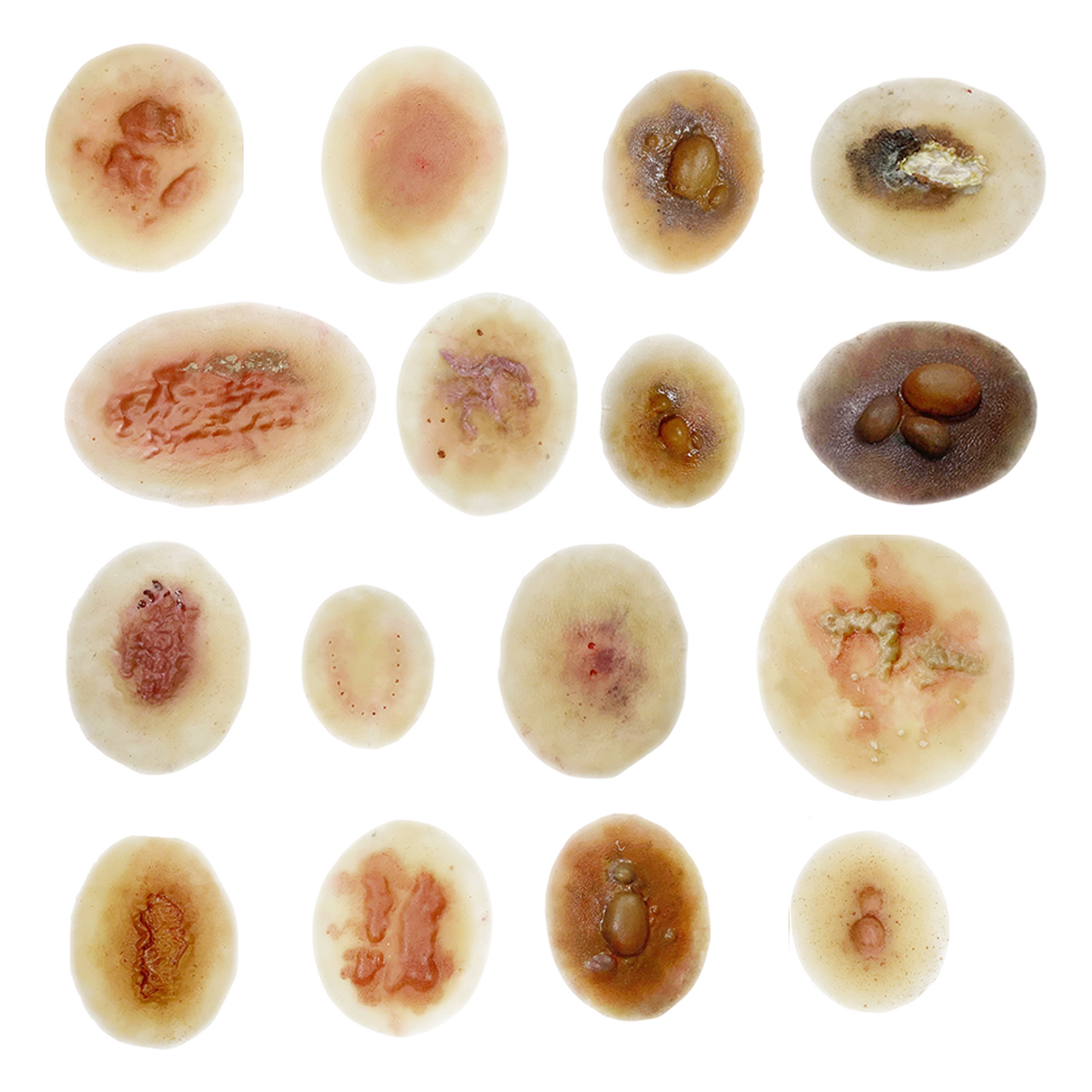 The Anatomy Lab-A-113003 Insect & Snake Bites Moulage Kit, 1/ea