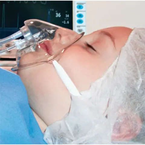 Sharn/Marketlab Capnoxygen EtCO2/O2 Sampling Mask