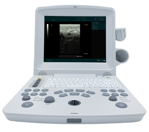 Ultrasonido en blanco y negro DUS60. No incluye transductor