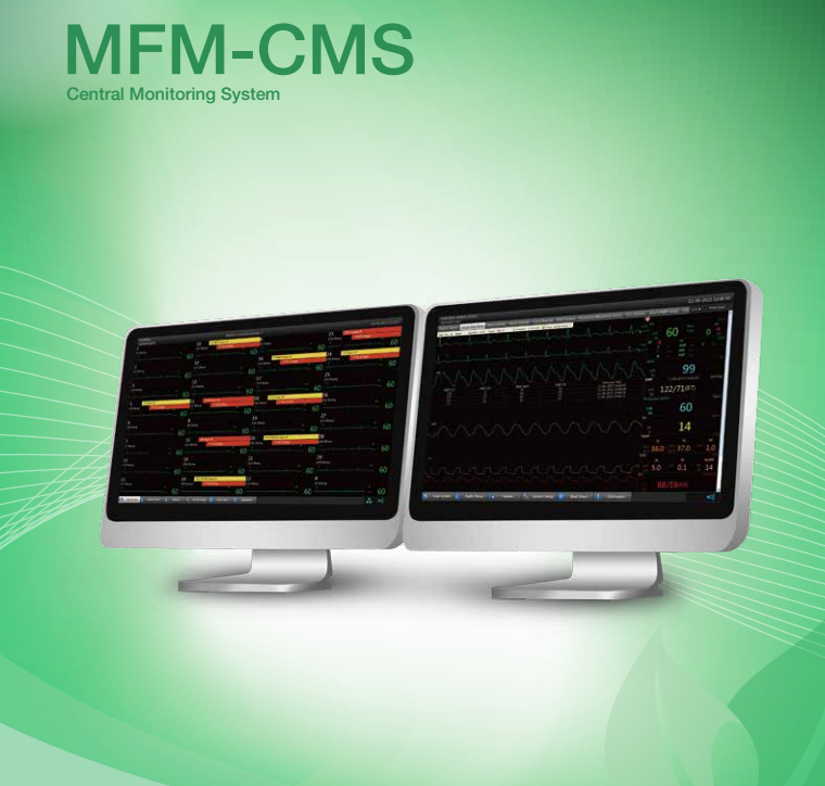 Estación de Monitoreo Central EDAN para monitorear hasta 64 camas en tiempo real desde una ubicación central. Monitoreo simultáneo de múltiples camas con comunicación bidireccional para cada monitor de cabecera