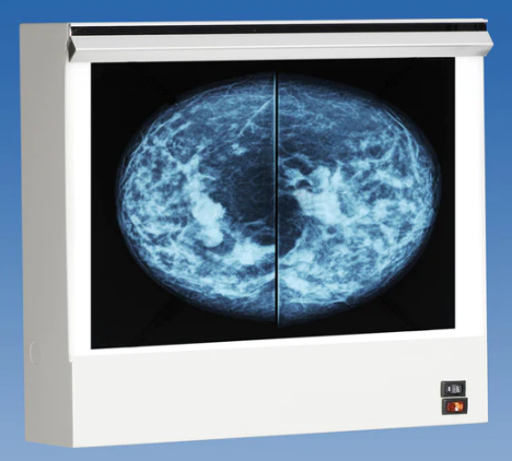 Wolf Xray VuPlus Mammography Viewer