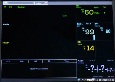 EDAN-X8-G2.P Monitor de paciente X8 con pantalla táctil de 8'' y Wi-Fi