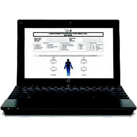 Newman Medical-ABI-120 Acer Computer for simpleABI Systems