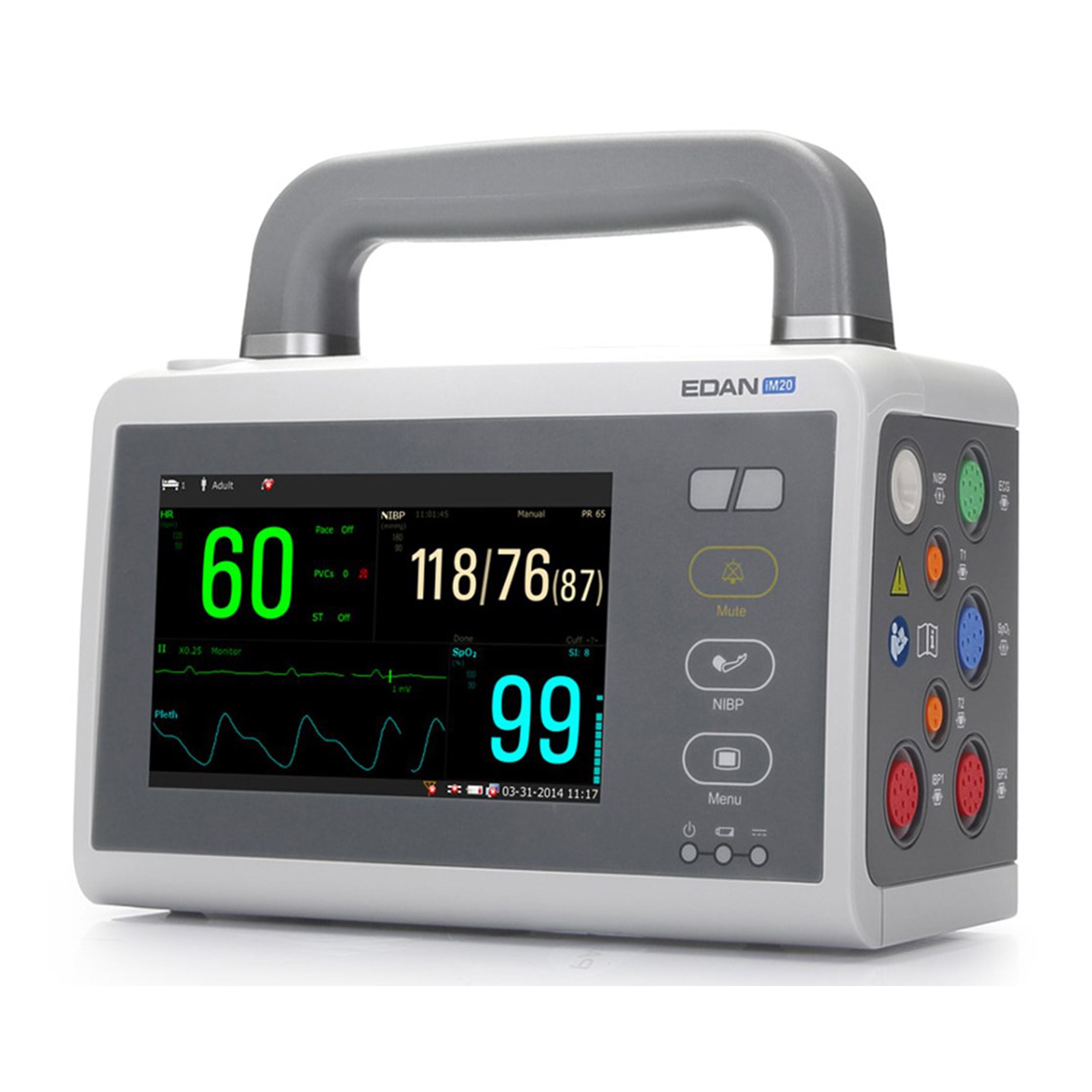 Reliable Edan IM20 Transport Patient Monitor – Efficient, Battery-Operated Monitoring Solution