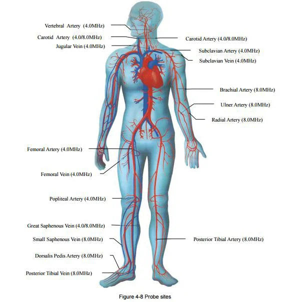 Doppler EDAN Sonotrax Basic A. Incluye pantalla retroiluminada y sonda fetal de 2 MHz