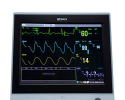 Monitor de paciente EDAN X12 con pantalla táctil de 12'' y Wi-Fi. Configuración estándar: ECG de 3/5 derivaciones, RESP, NIBP, Edan SpO2, 2-TEMP, PR, HR y memoria interna para revisión de datos anteriores. Impresora instalada en el lateral de la unidad.