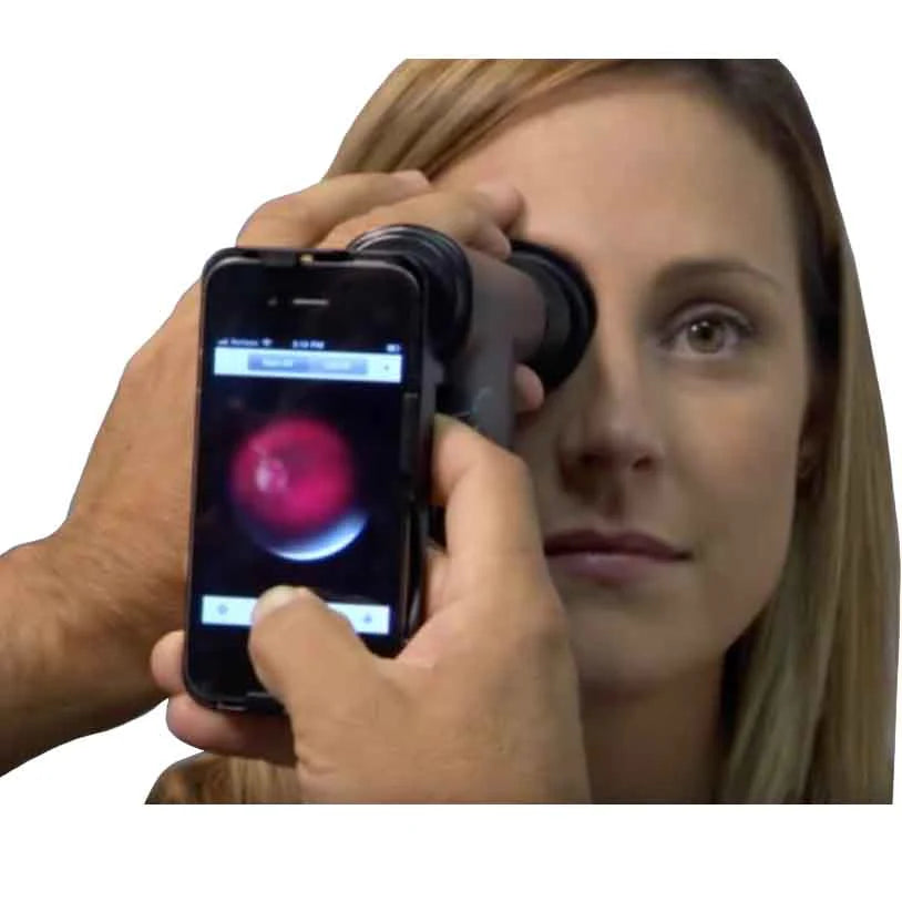 Welch Allyn iExaminer Phone Adapter