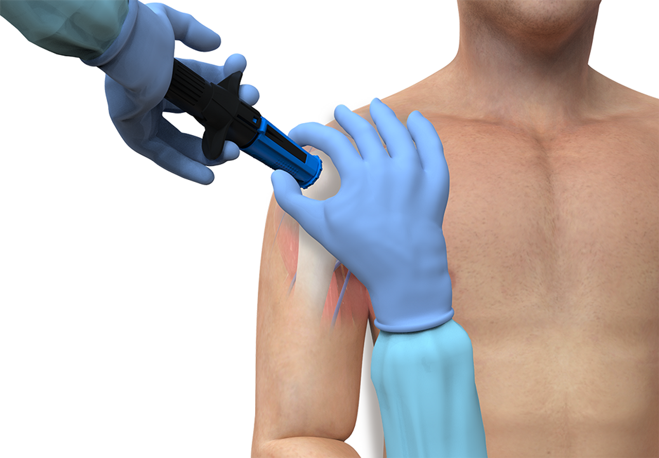 Safeguard Medical NIO - Fixation Dressing