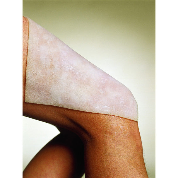 Safeguard Medical BurnFree Burn Dressings