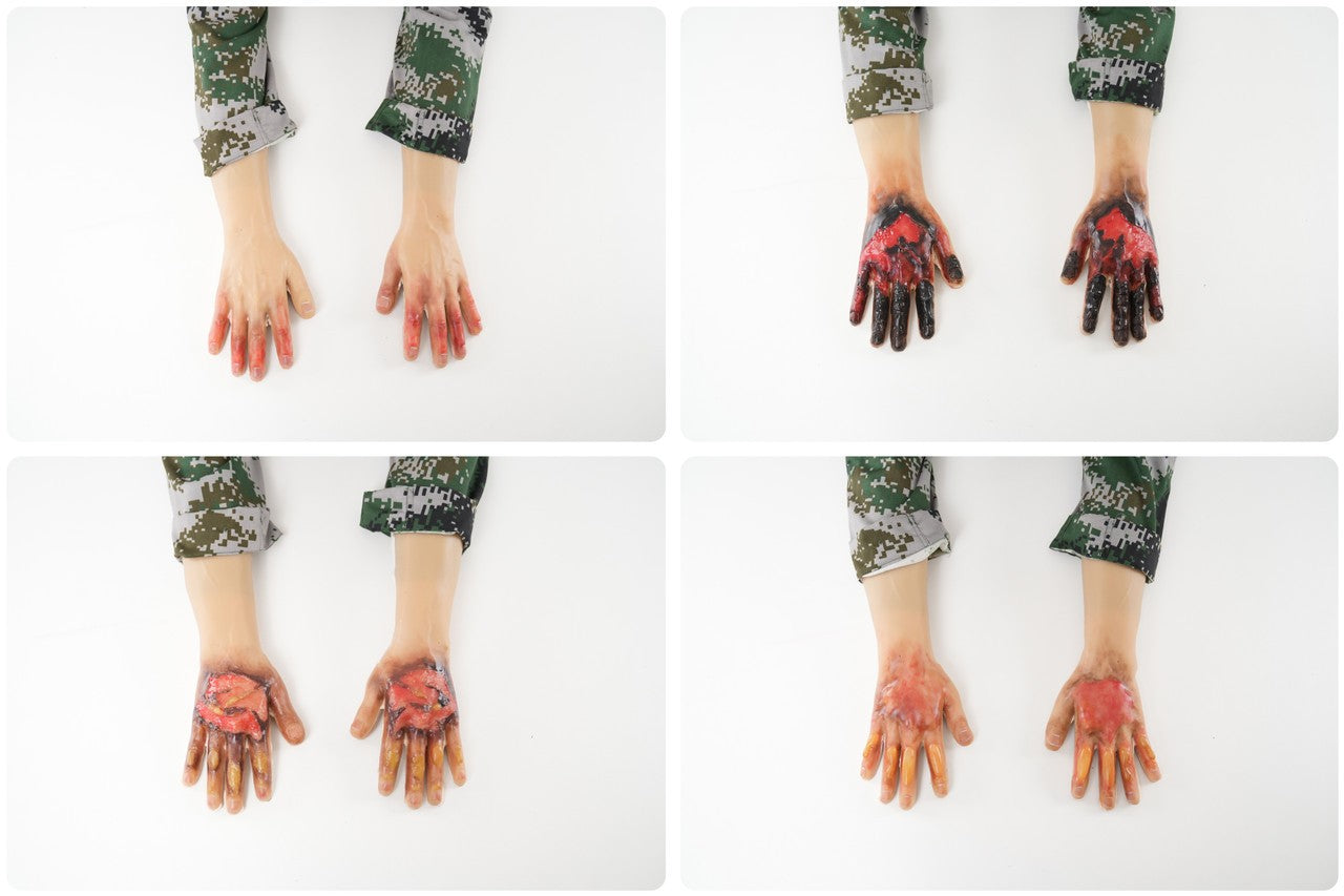 The Anatomy Lab-A-113000 Wearable Burn Wound Kit, 1/SET