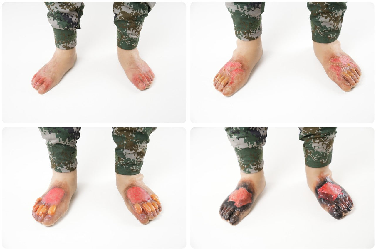 The Anatomy Lab-A-113000 Wearable Burn Wound Kit, 1/SET