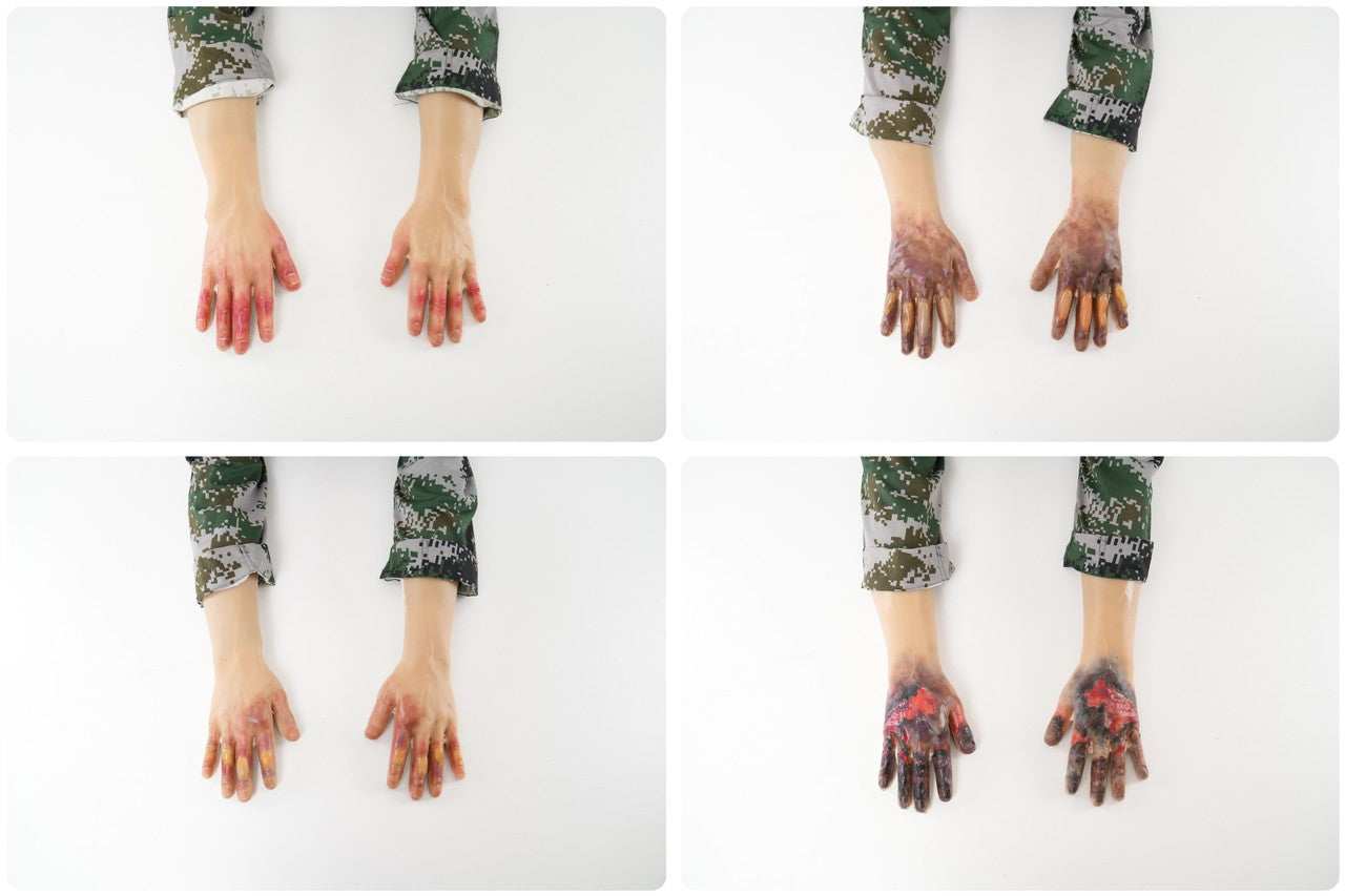 The Anatomy Lab-A-113004 Wearable Frostbite Injury Kit, 1/ea