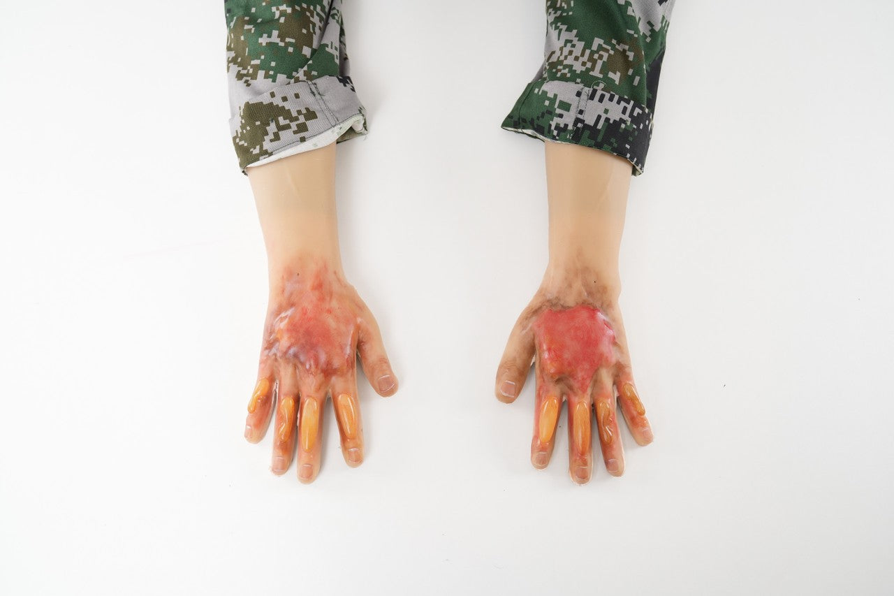 The Anatomy Lab-A-113000 Wearable Burn Wound Kit, 1/SET