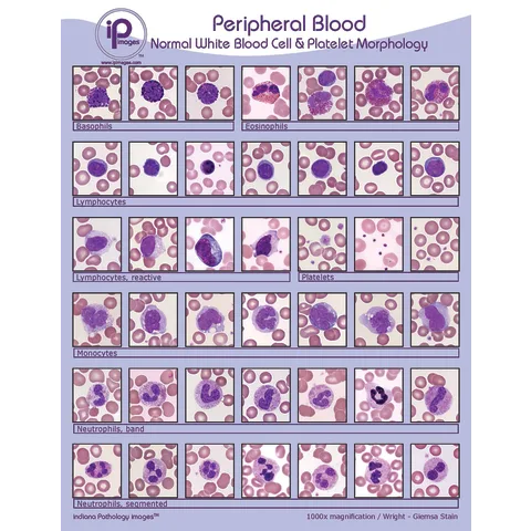 Marketlab Peripheral Blood Poster – Normal White Blood Cell & Platelet ...