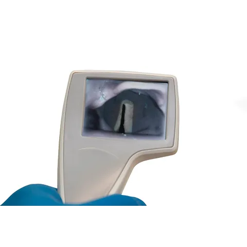 Sharn/Marketlab-101761 i-view™ Disposable Video Laryngoscope, 1 ea / Qty per ea: 2