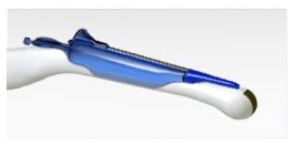 Aspen Surgical Protek Endocavity Needle Guides