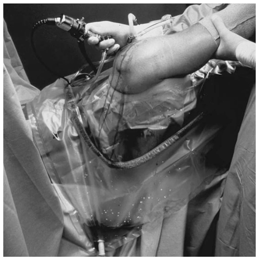 Solventum/3M-Steri-Drape™ U-Drapes