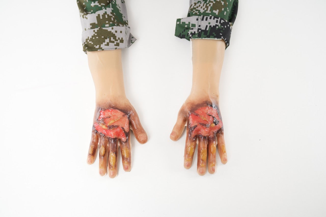 The Anatomy Lab-A-113000 Wearable Burn Wound Kit, 1/SET