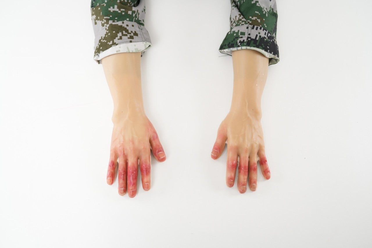 The Anatomy Lab-A-113004 Wearable Frostbite Injury Kit, 1/ea