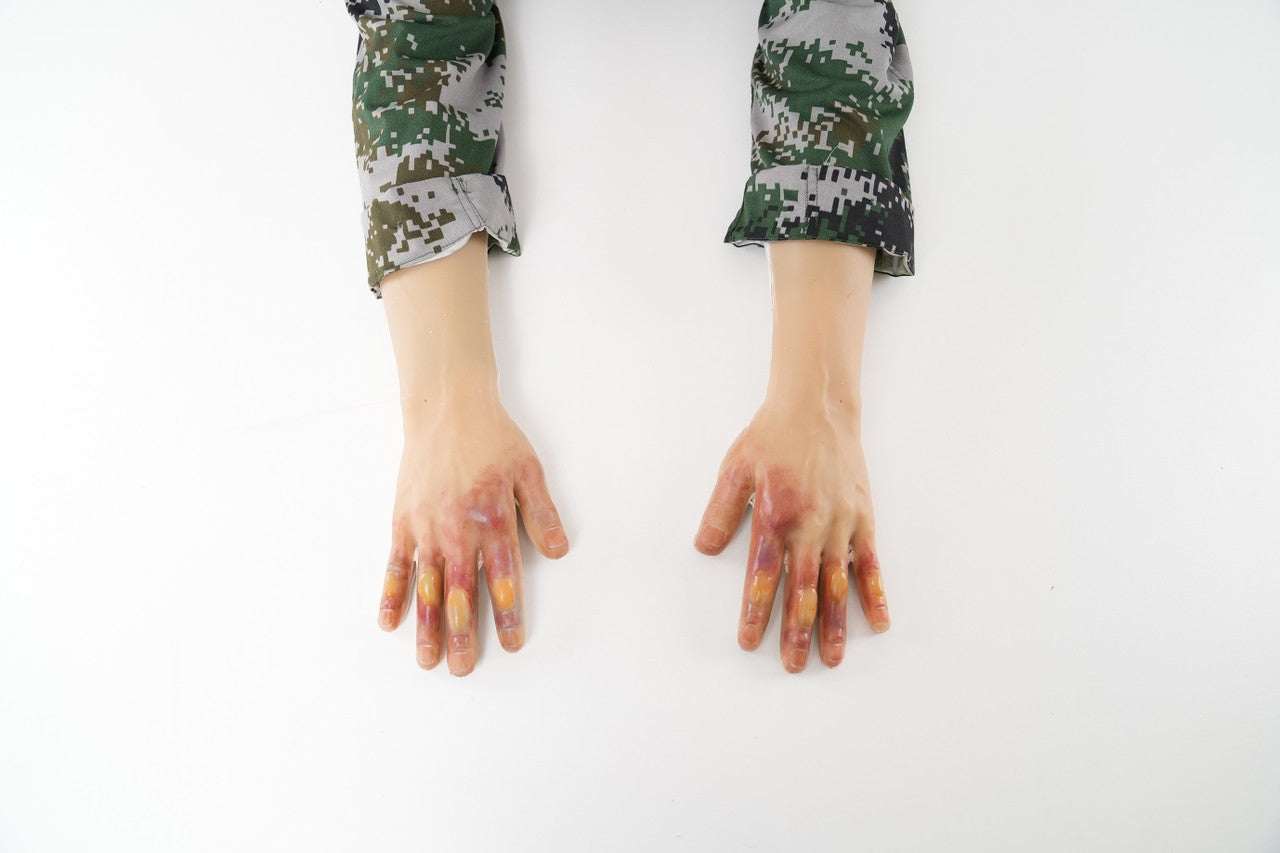 The Anatomy Lab-A-113004 Wearable Frostbite Injury Kit, 1/ea