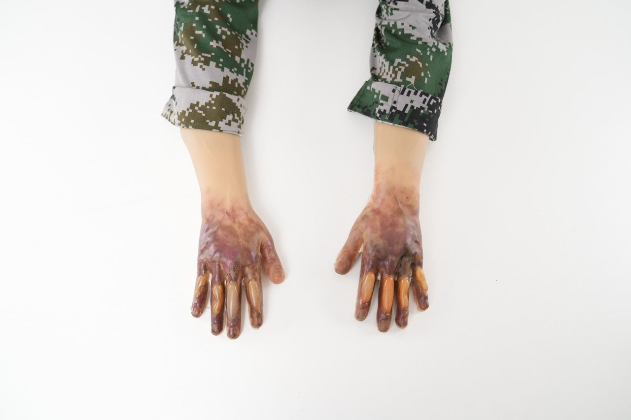 The Anatomy Lab-A-113004 Wearable Frostbite Injury Kit, 1/ea