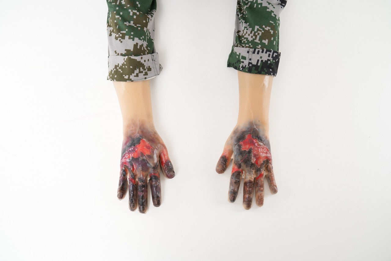 The Anatomy Lab-A-113004 Wearable Frostbite Injury Kit, 1/ea