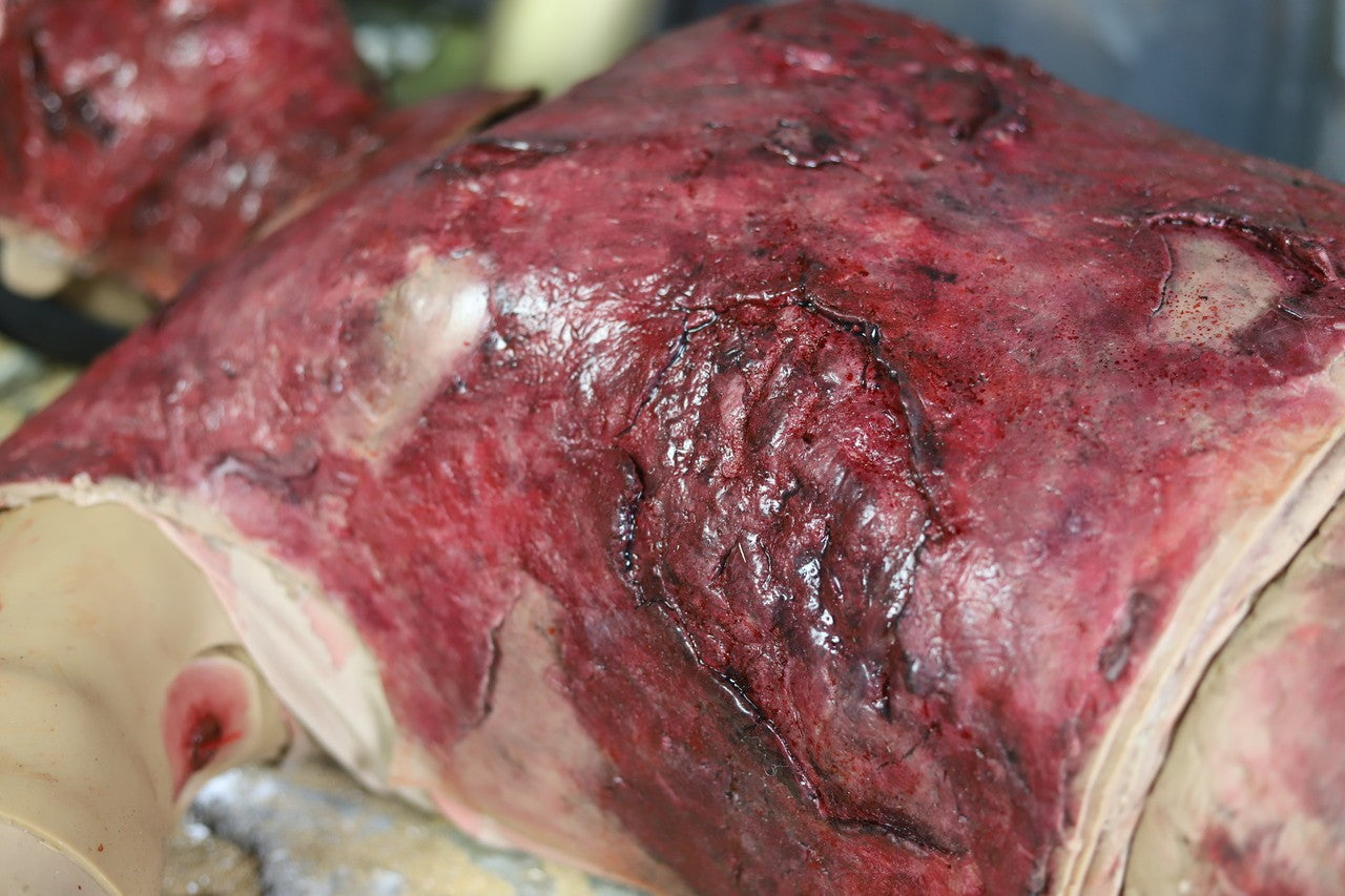 The Anatomy Lab-A-113000 Wearable Burn Wound Kit, 1/SET