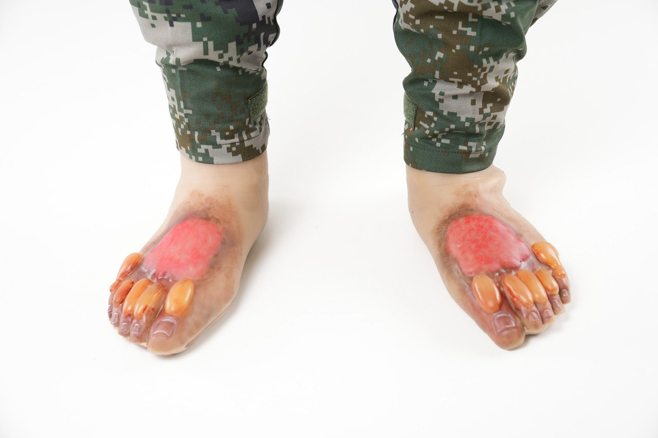 The Anatomy Lab-A-113000 Wearable Burn Wound Kit, 1/SET