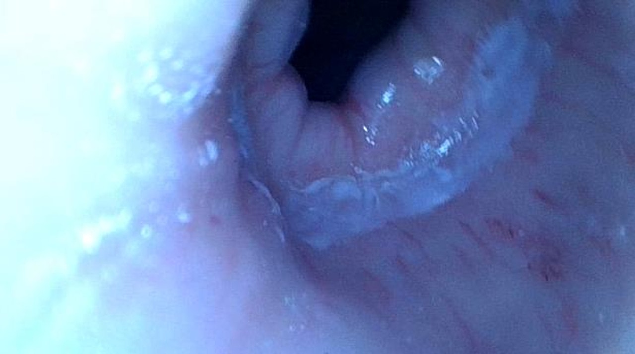 The Anatomy Lab-A-113016 Upper GI Endoscopy Training Model, 1/ea