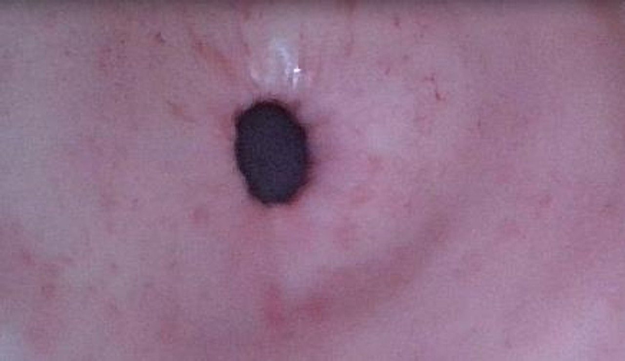 The Anatomy Lab-A-113016 Upper GI Endoscopy Training Model, 1/ea