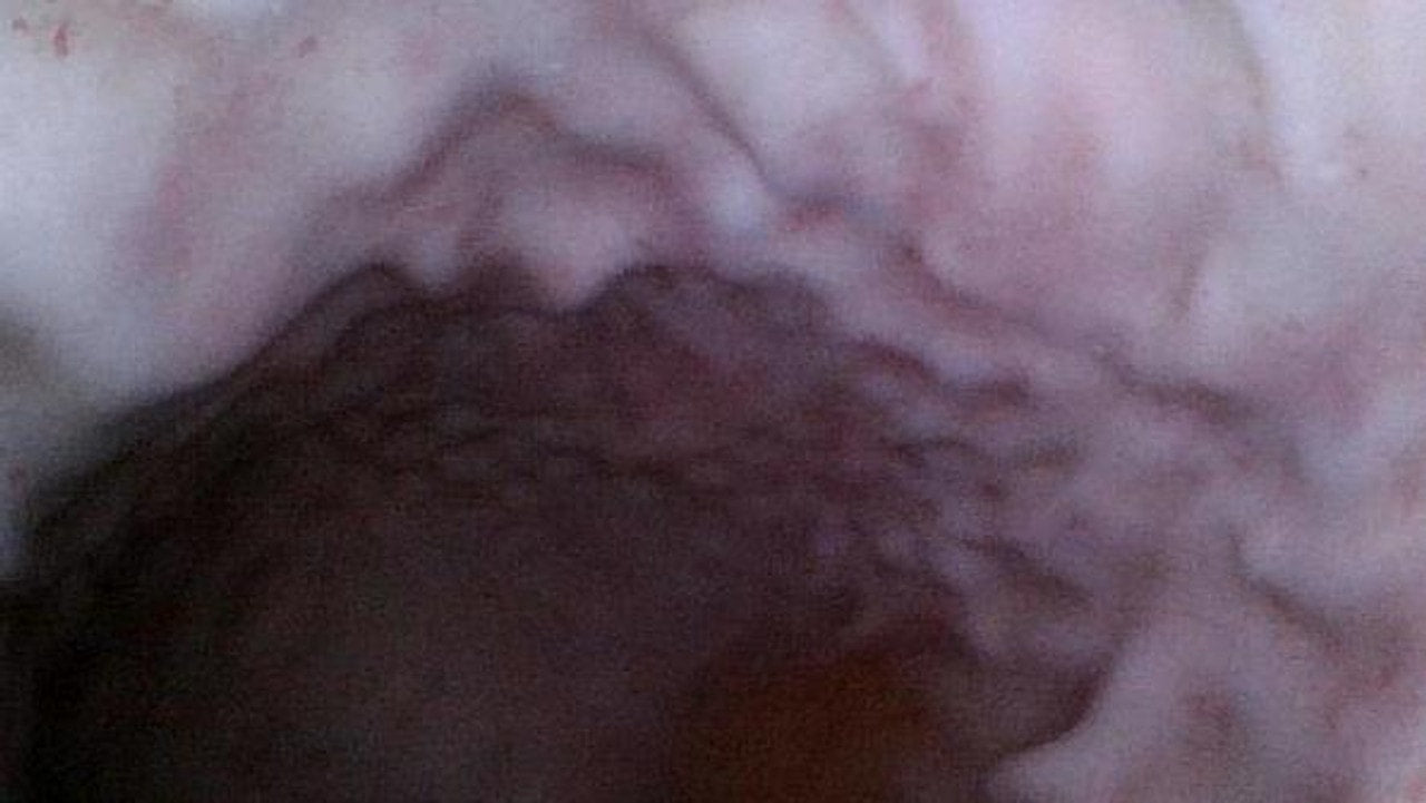 The Anatomy Lab-A-113016 Upper GI Endoscopy Training Model, 1/ea