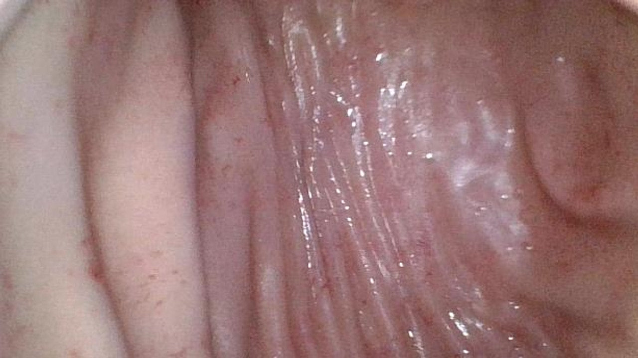 The Anatomy Lab-A-113016 Upper GI Endoscopy Training Model, 1/ea