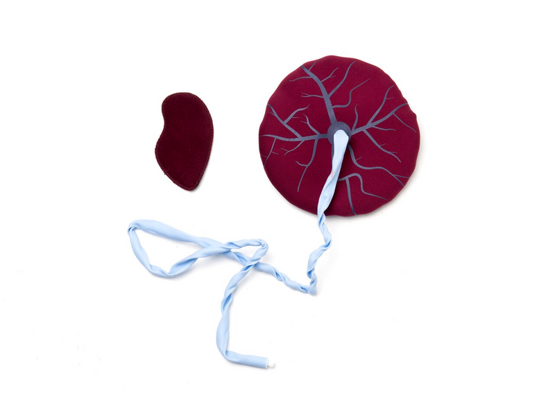 Laerdal-340-17033 Mamanatalie Placenta Kit 1/Ea