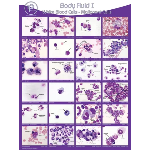 Marketlab Body Fluid Pathology Reference Poster