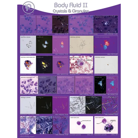 Marketlab Body Fluid Pathology Reference Poster