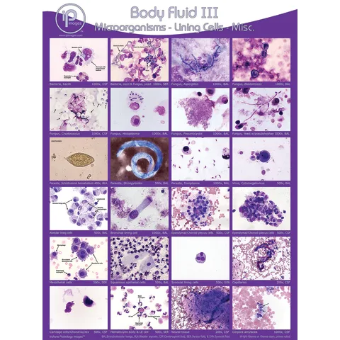 Marketlab Body Fluid Pathology Reference Poster