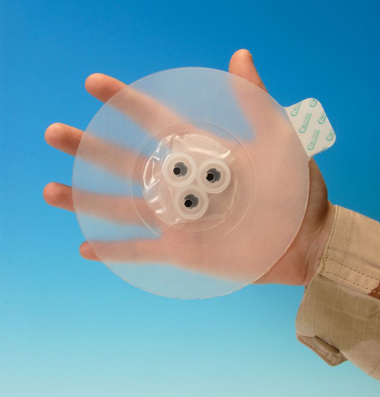 Safeguard Medical Bolin Chest Seal