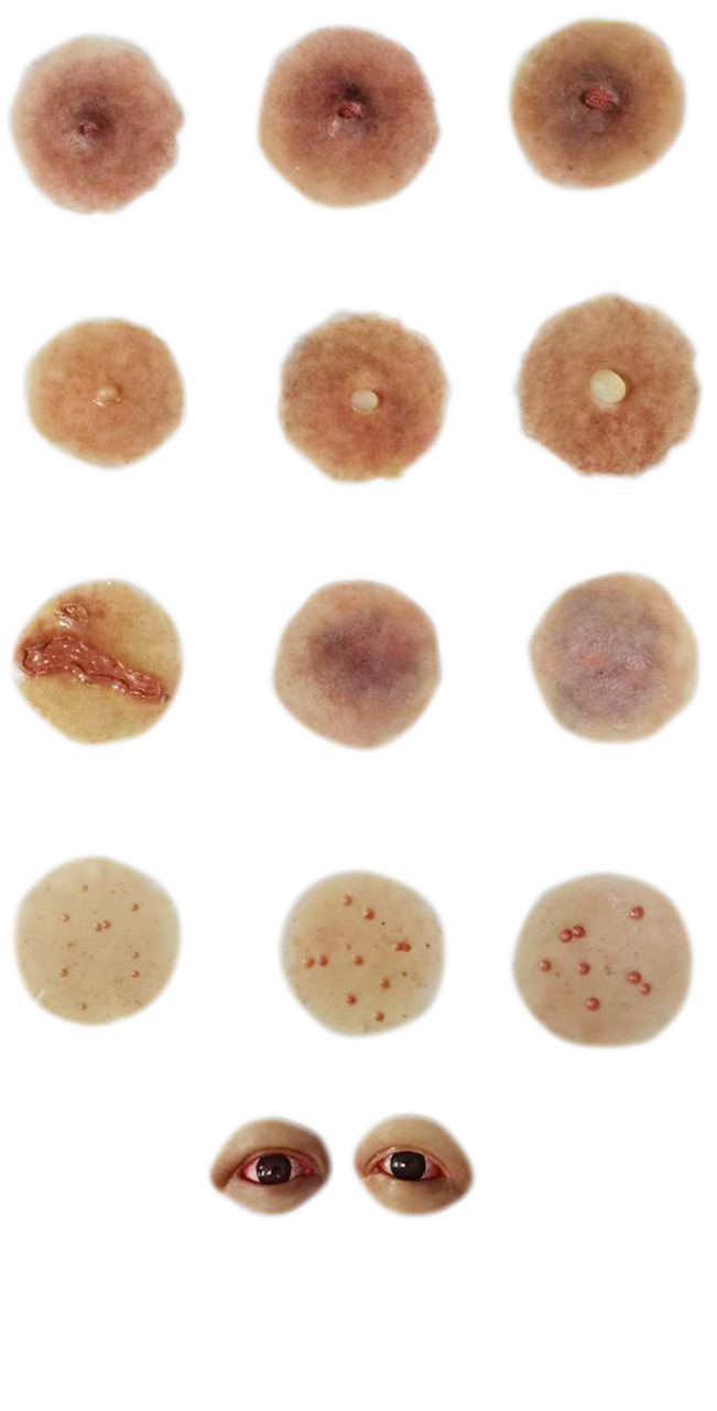 The Anatomy Lab-A-112998 CBRN Injury Moulage Kit, 1/set