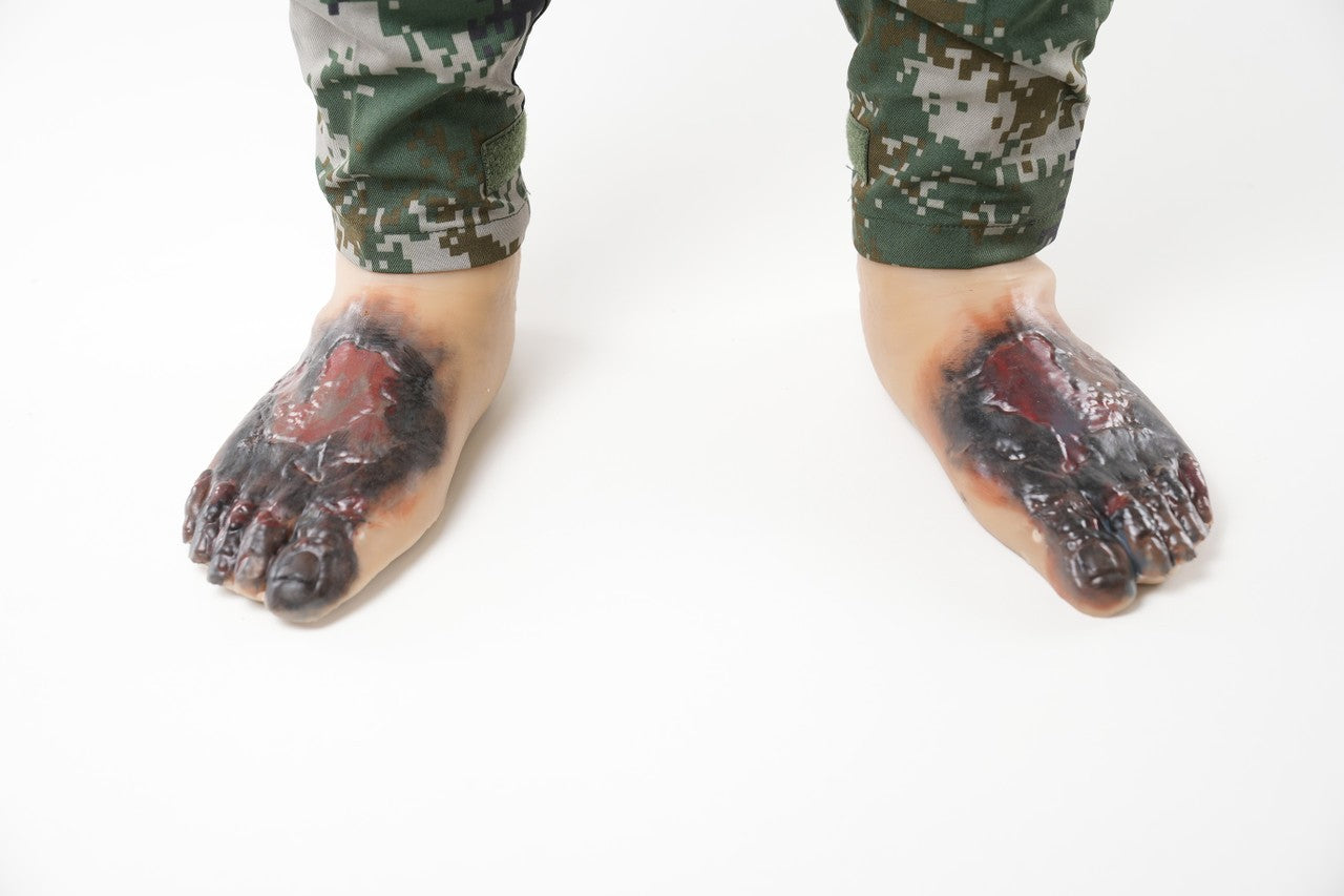 The Anatomy Lab-A-113004 Wearable Frostbite Injury Kit, 1/ea