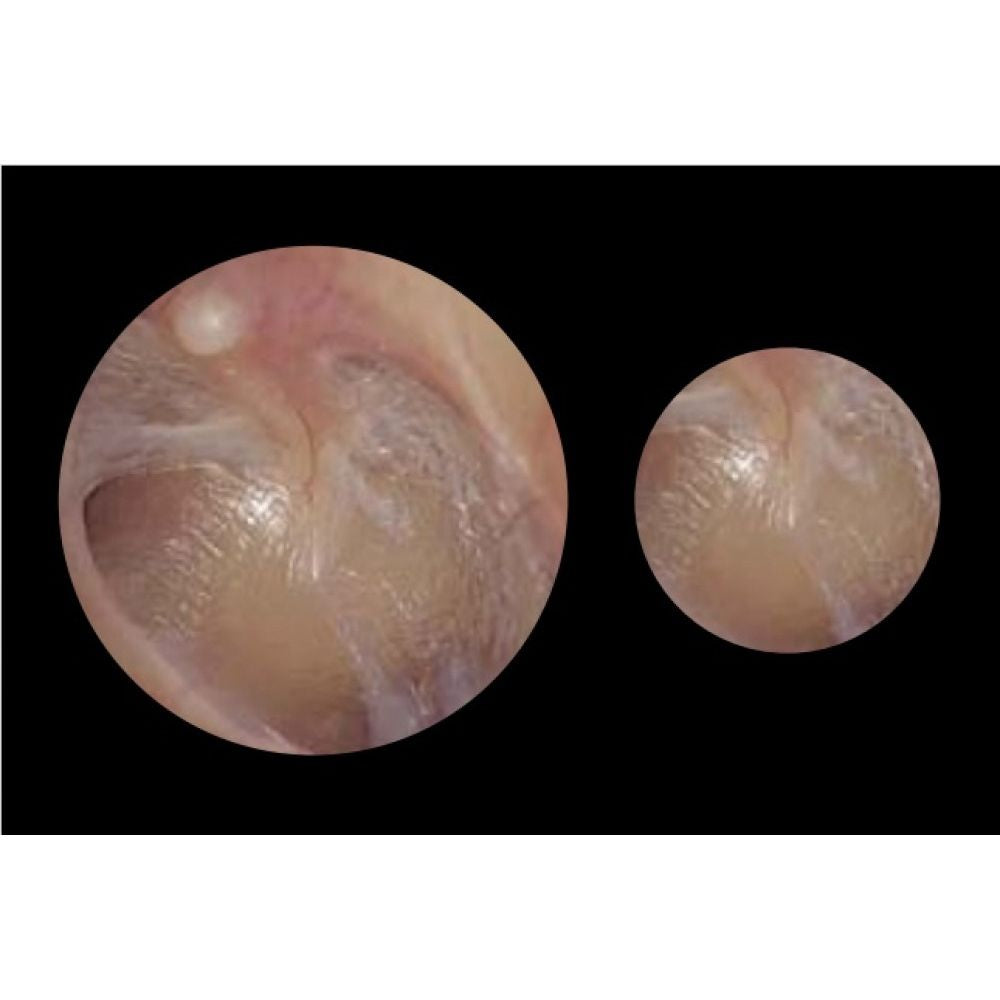 ADC Diagnostix 55802 3.5V PMV Otoscope/Coax Plus Ophthalmoscope Diagnostic Desk Set