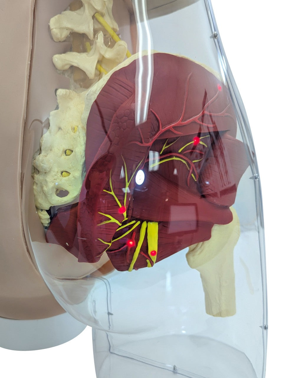 The Anatomy Lab-A-104413 Buttock Intramuscular Injection Model, 1/ea