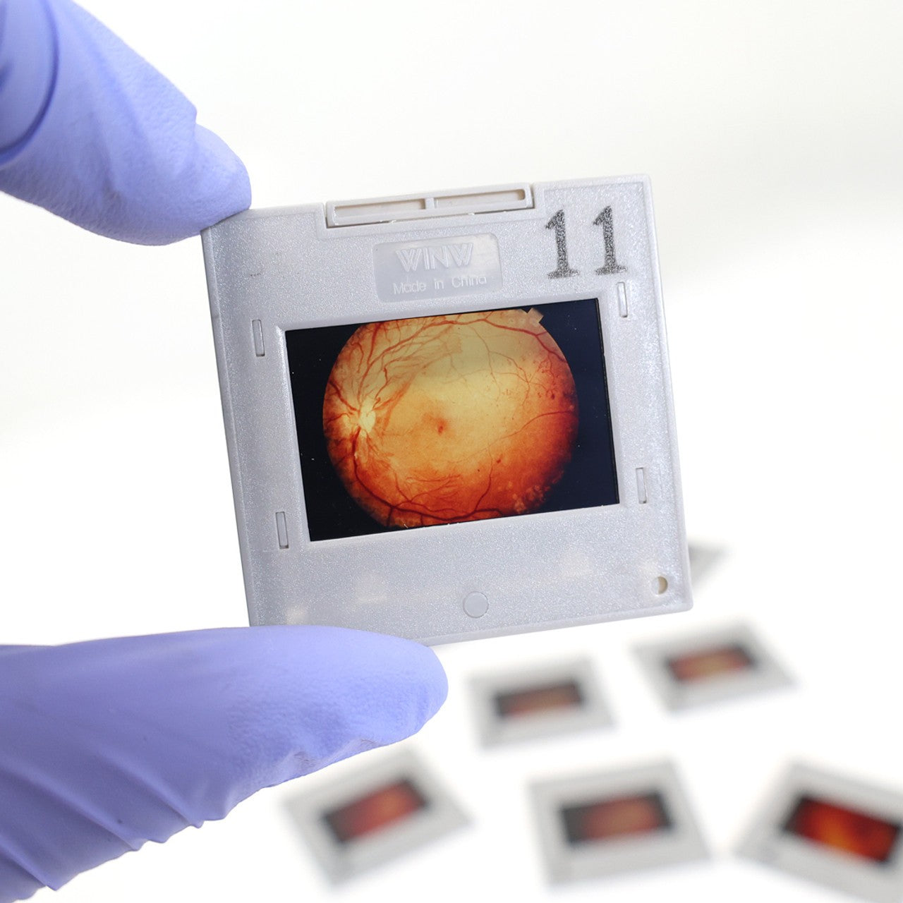 The Anatomy Lab-A-104445 Eye Retinopathy Trainer, 1/ea