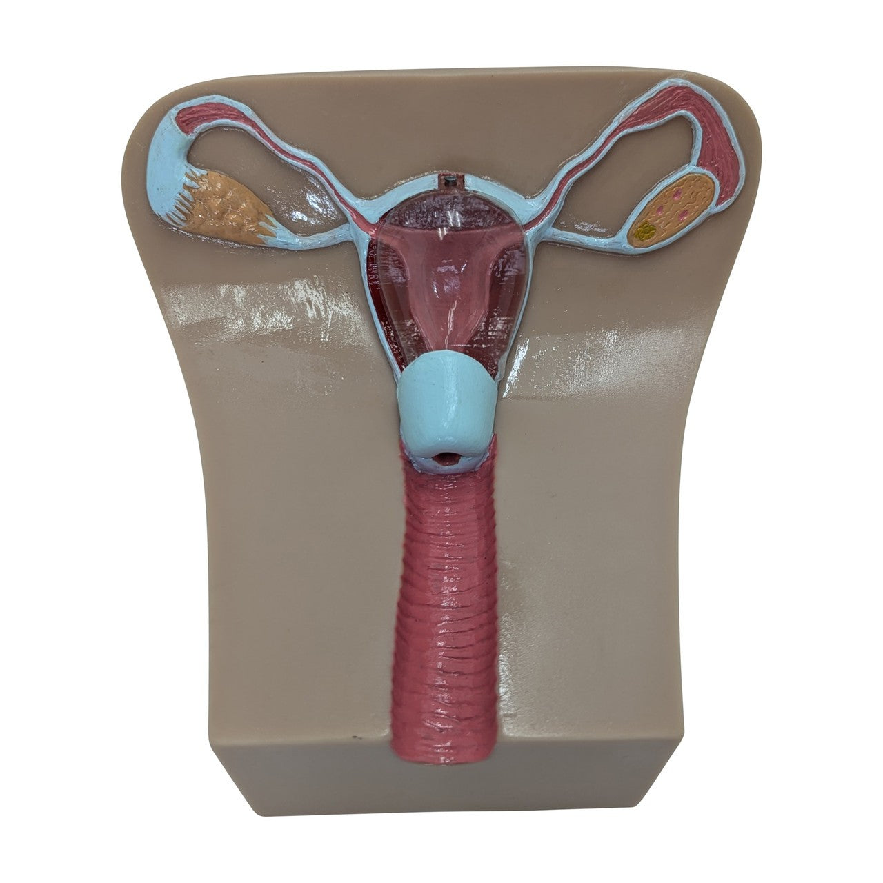 The Anatomy Lab-A-104452 IUD Insertion Model I, 1/ea