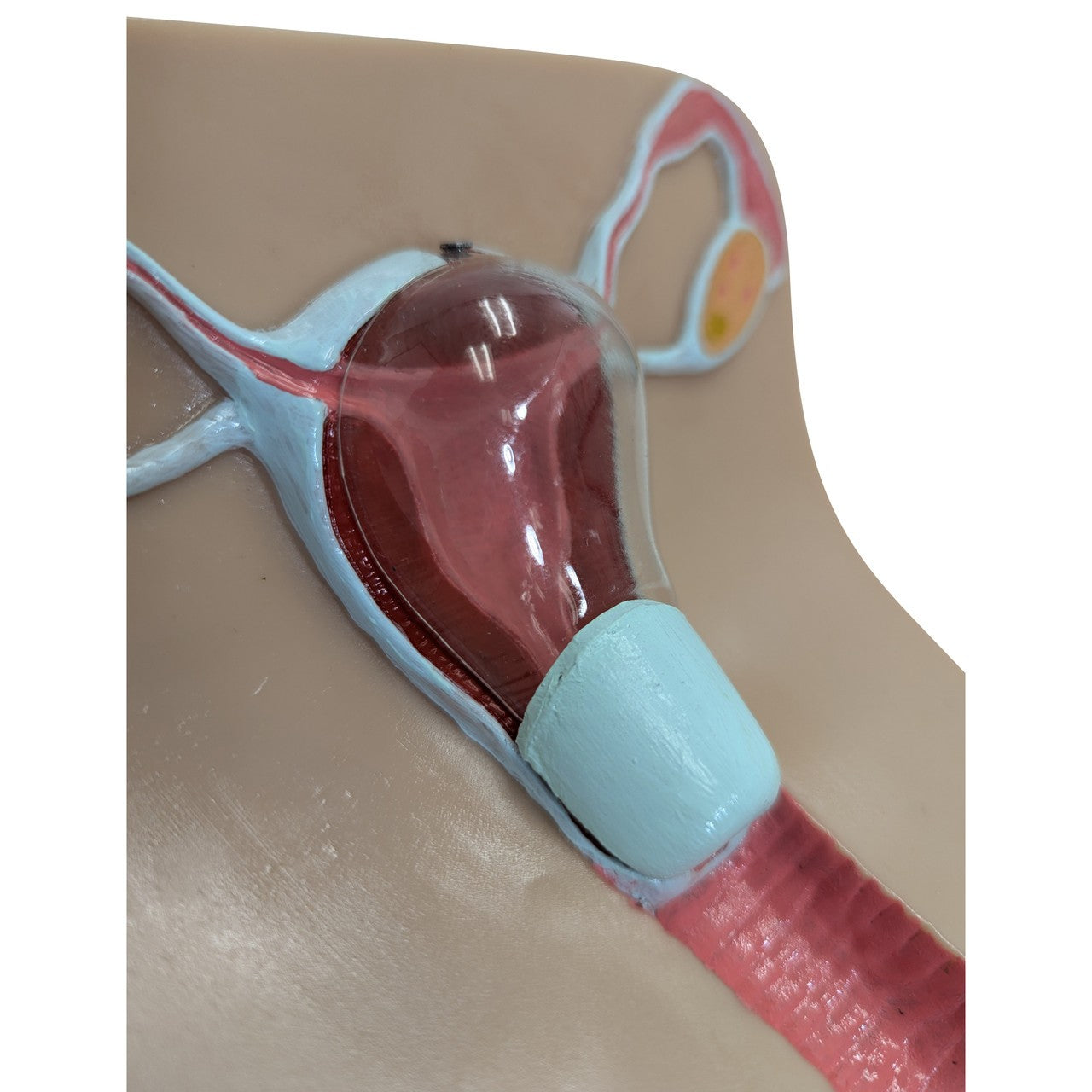 The Anatomy Lab-A-104452 IUD Insertion Model I, 1/ea