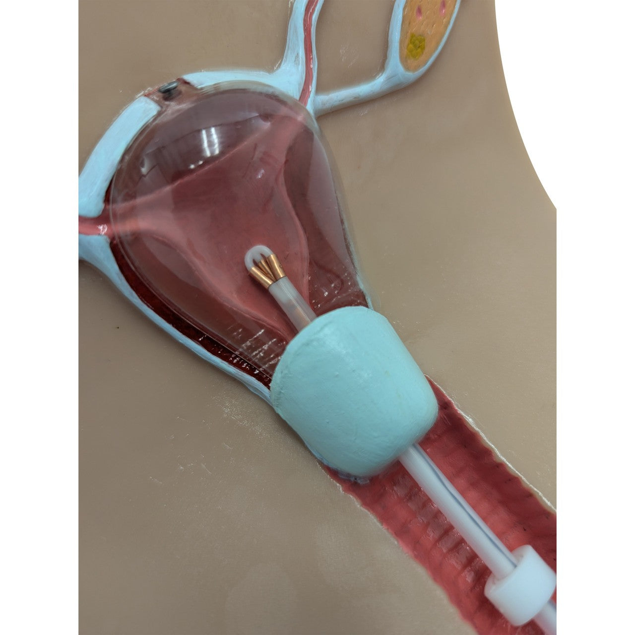 The Anatomy Lab-A-104452 IUD Insertion Model I, 1/ea