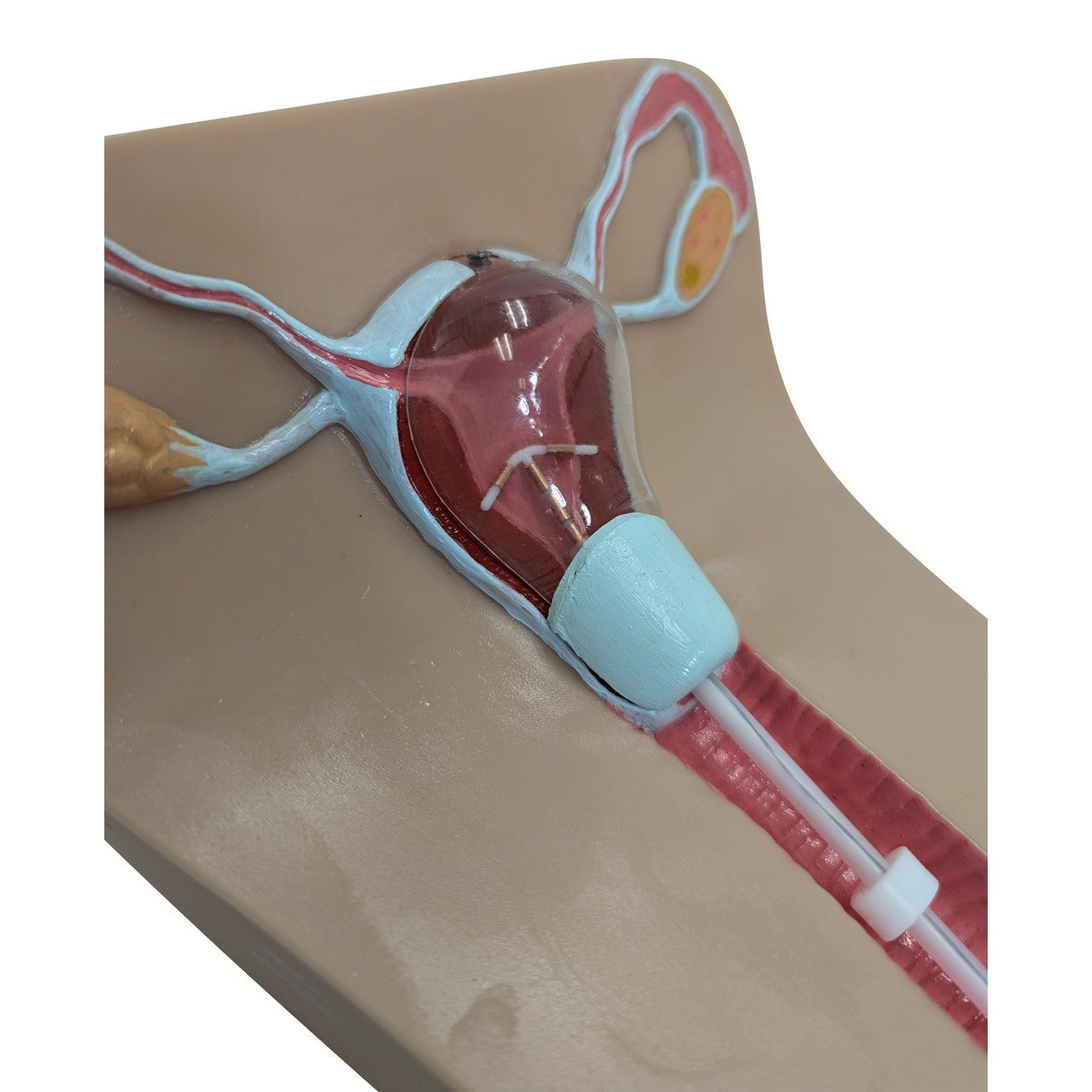 The Anatomy Lab-A-104452 IUD Insertion Model I, 1/ea
